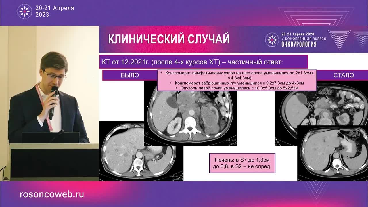 Какому подходу отдать предпочтение в 1 линии лечения метастатического РМП? Клинический случай