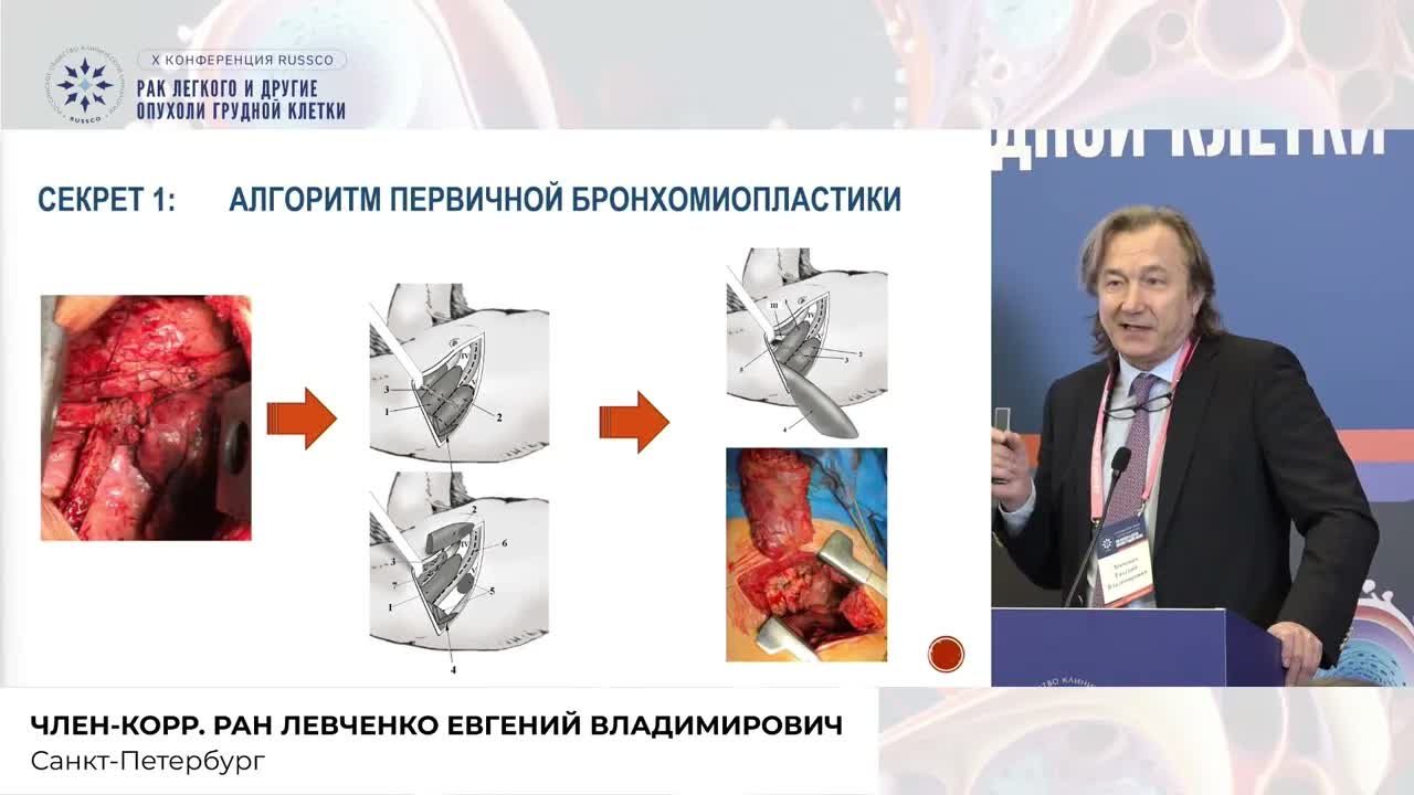 Секреты бронхопластики