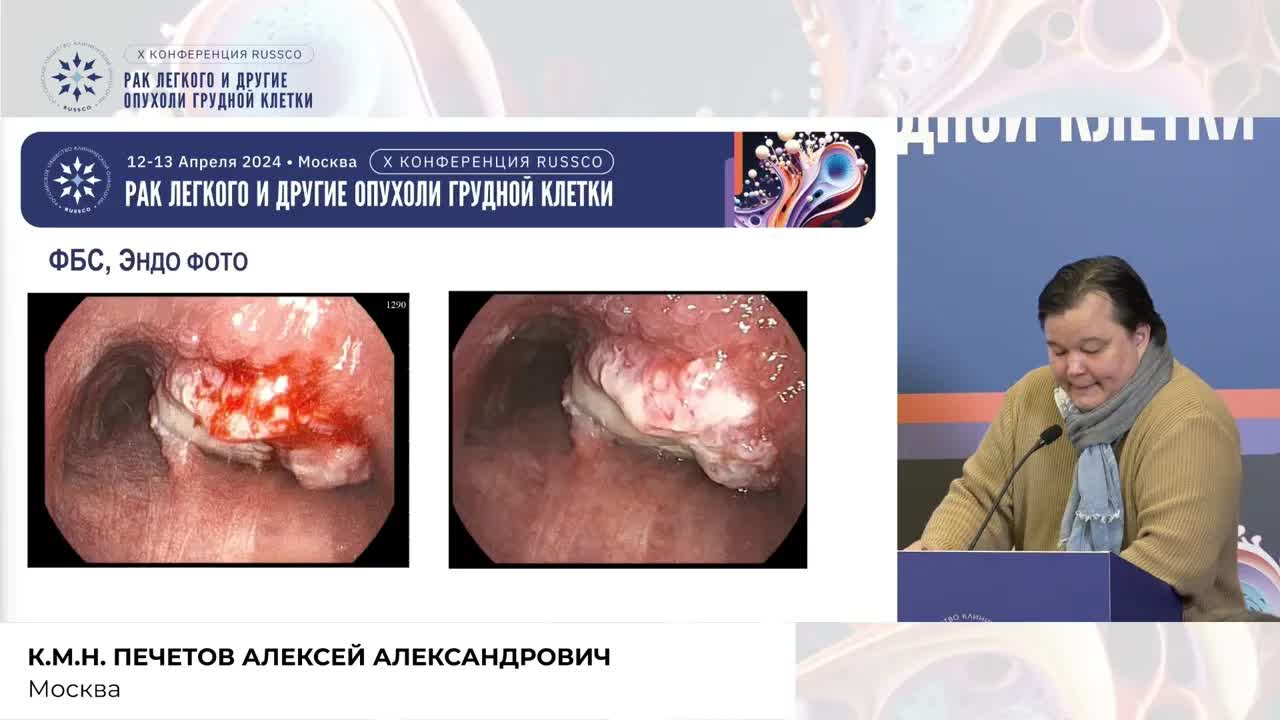 Стенозирующий рак дистального отдела трахеи с переходом на правый главный бронх, что делать?