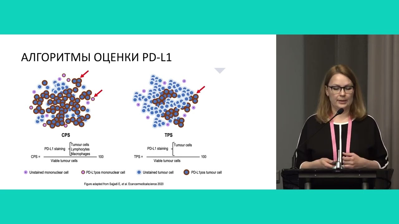 Влияние молекулярно-генетической классификации на выбор лечения: рак желудка