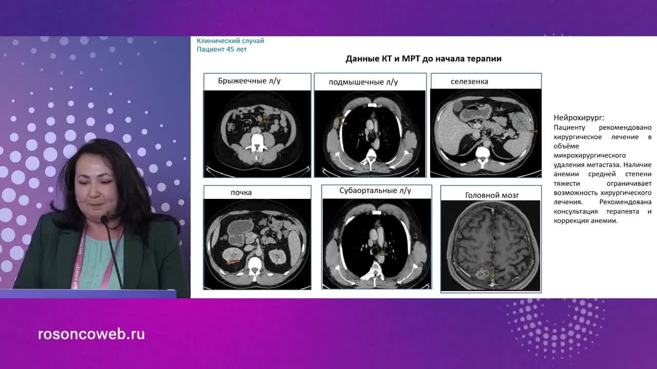 Лекарственная терапия BRAF меланомы. Большой объем опухоли: кл.случай
