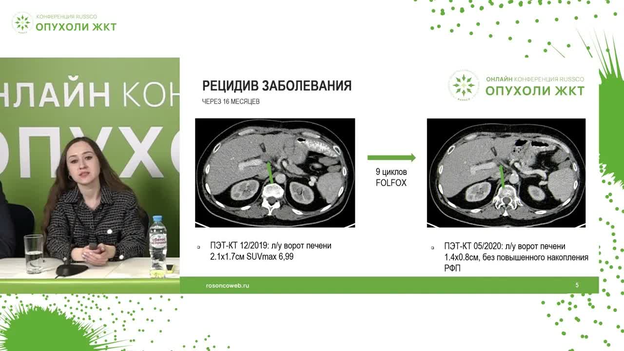 Клинический случай. Комплексное лечение рака желудка