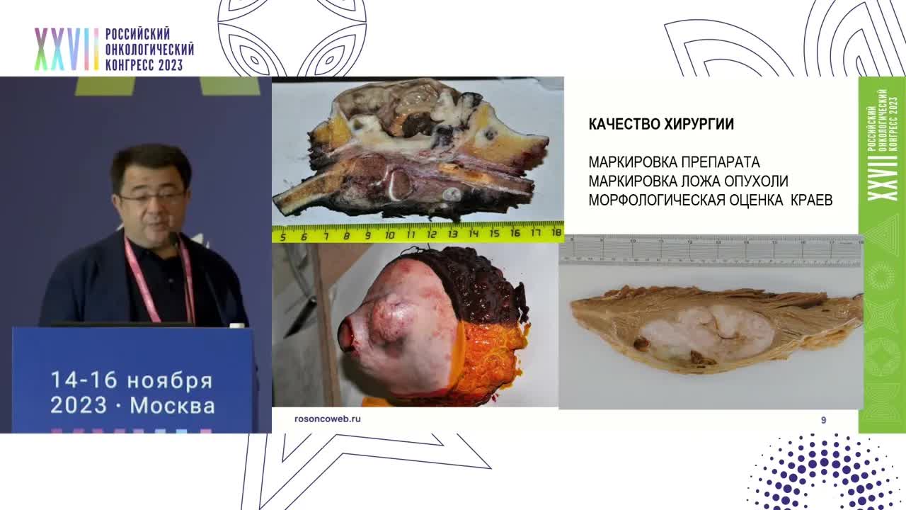 Диагностика сарком. Что делать, когда диагноза нет