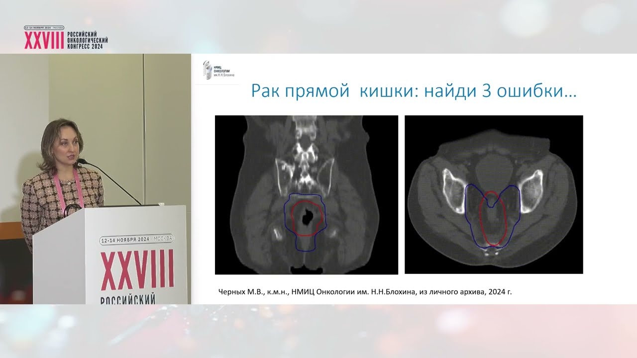 Качество в количество: применение протоколов гарантии качества в отделении радиотерапии