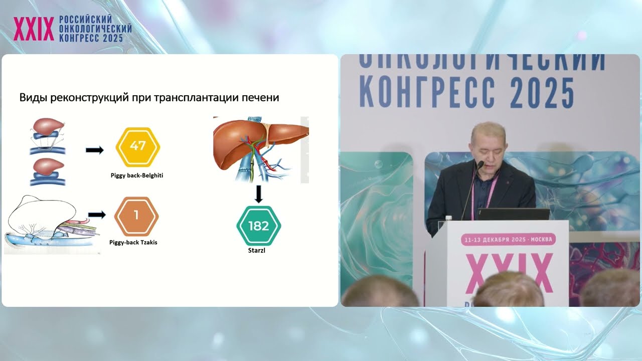 Трансплантация при нерезектабельных опухолях печени и желчных протоков