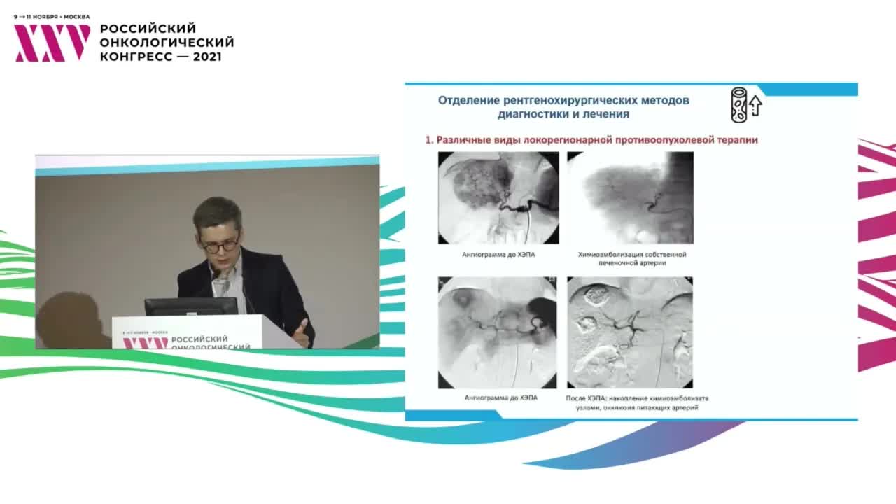 Федеральный проект как катализатор развития высокотехнологичной персонализированной онкологической помощи в регионе 