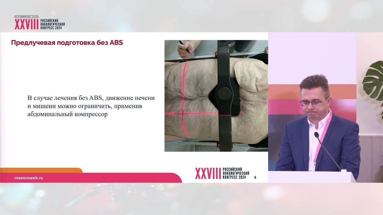 Лучевая терапия: невозможное возможно