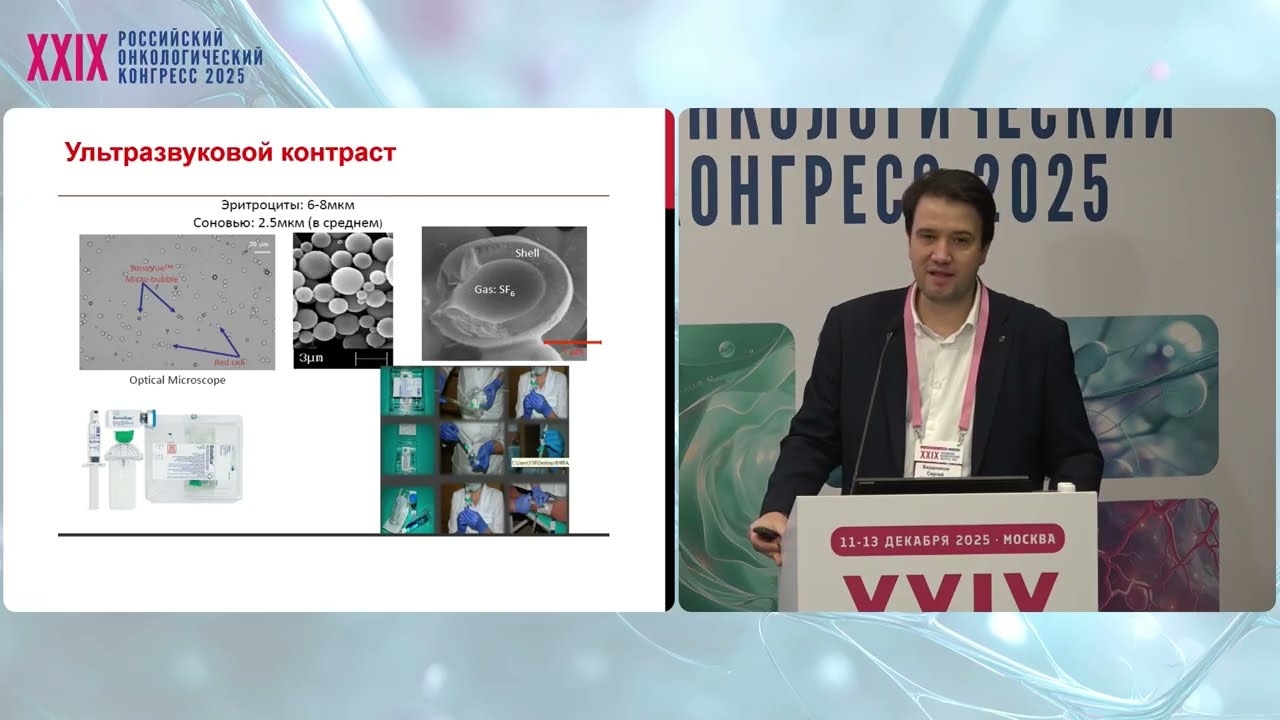 УЗИ в диагностике опухолей печени