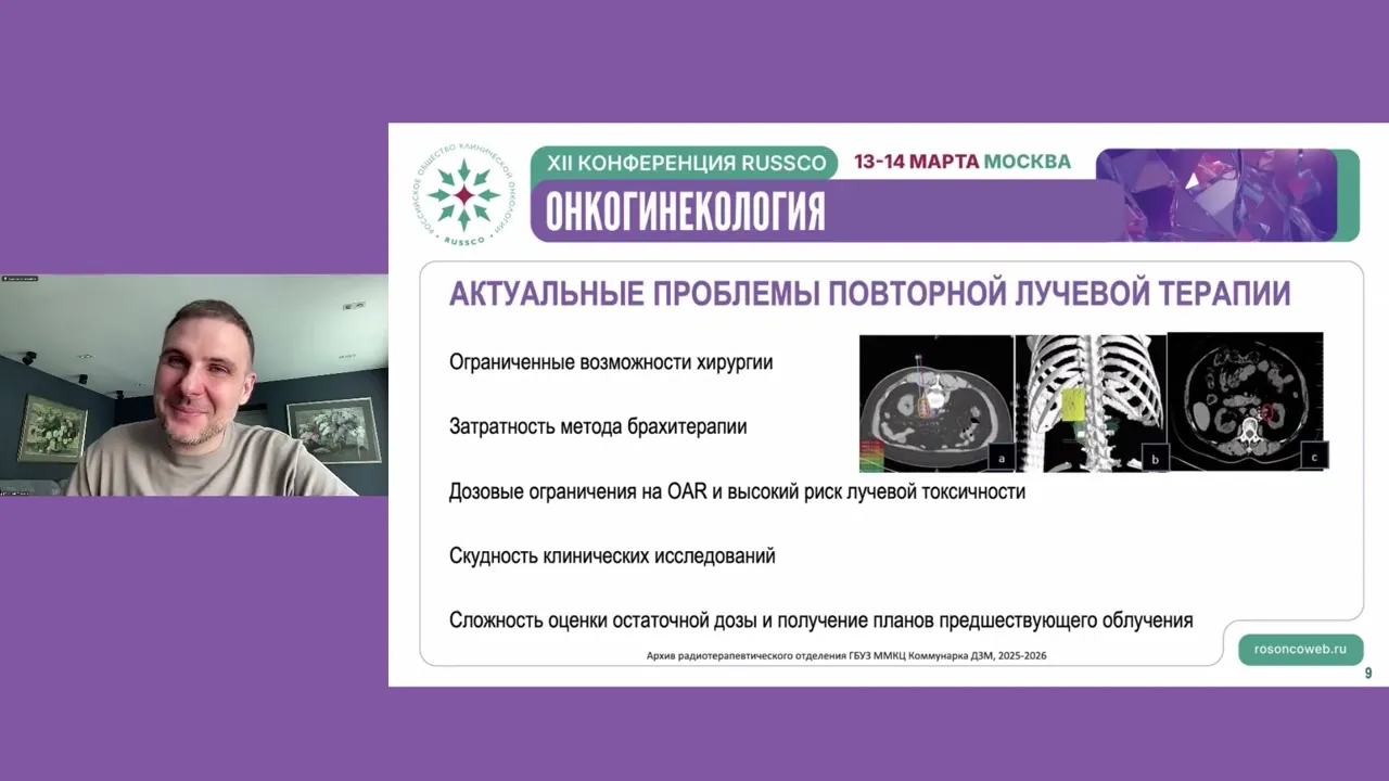 Рецидив РШМ в малом тазу. Когда показана ХЛТ (а когда возможна повторная ЛТ?)