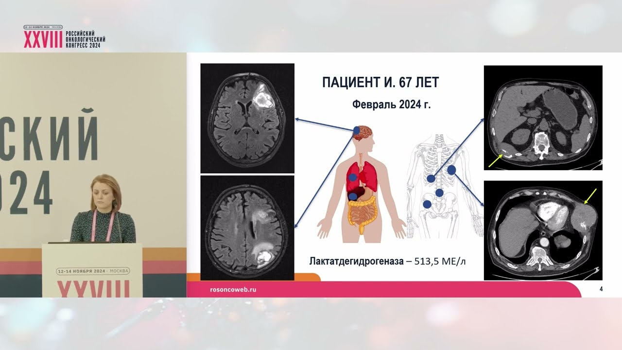 Клинический случай: иммуноопосредованный увеит