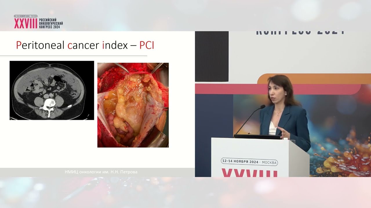 Считать или не считать? Клиническое значение определения PCI