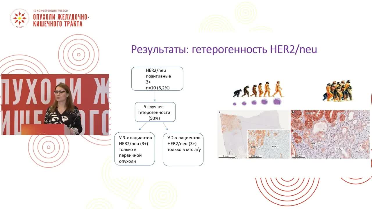 Оценка гетерогенности молекулярно-генетических маркеров при раке желудка