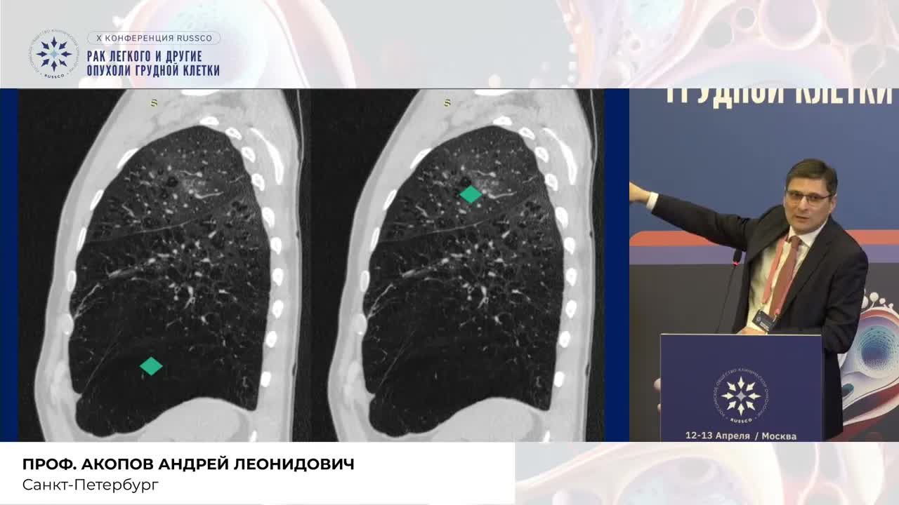 Операбельность и резектабельность – стирая границы объективности