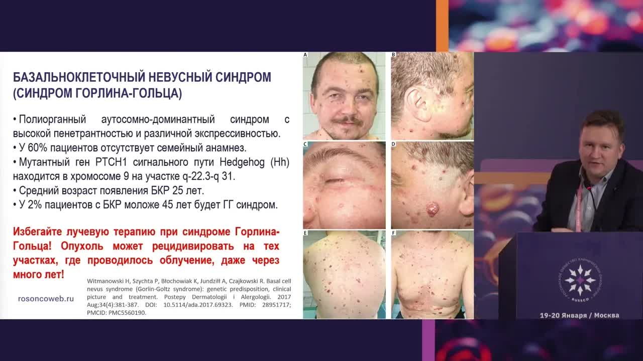 Системная терапия базальноклеточного рака кожи