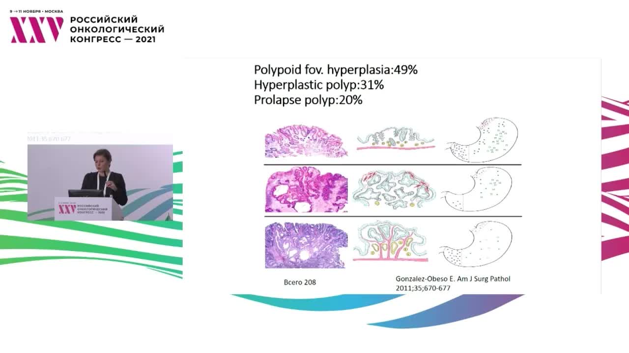 Эндоскопические и морфологические характеристики полипов желудка