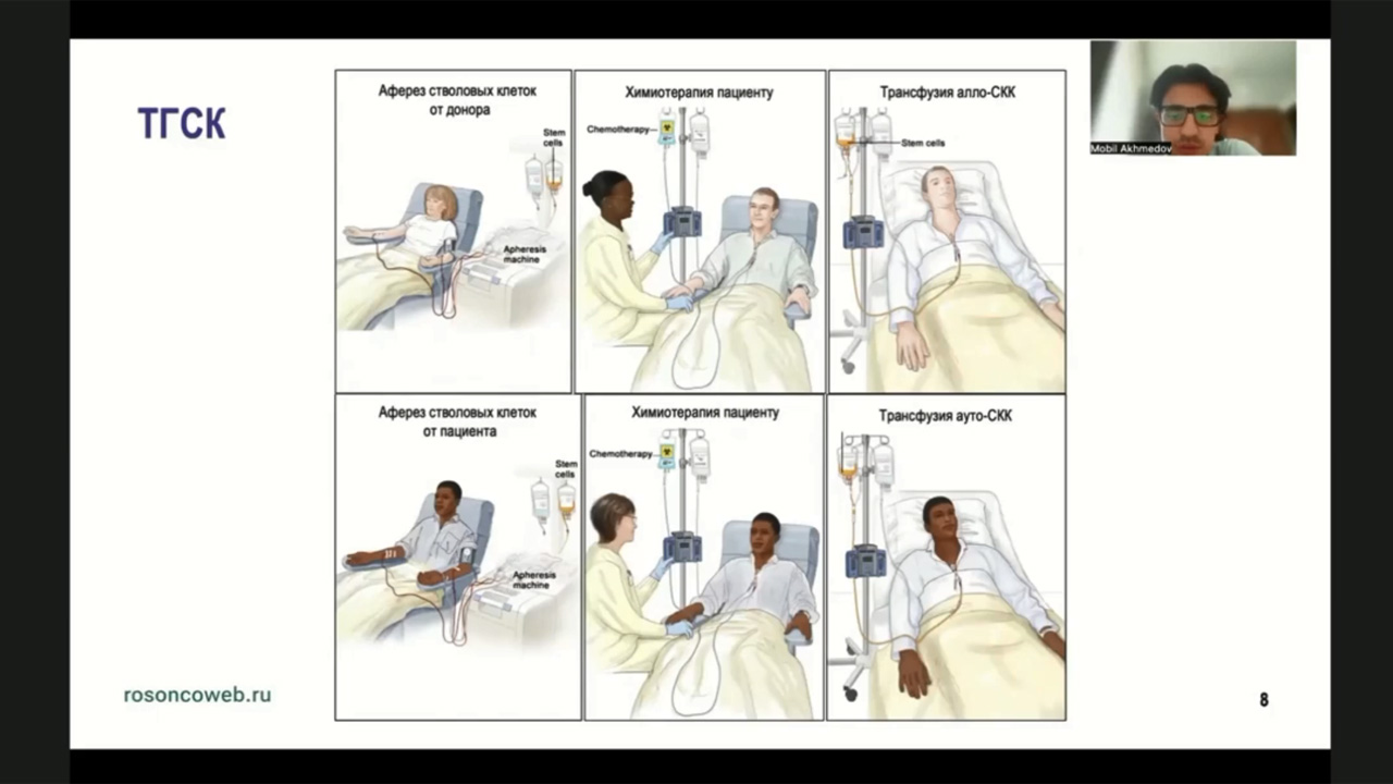 Академия RUSSCO для подготовки к экзамену ESMO: Гематология. Часть 1 (27 сентября 2025)