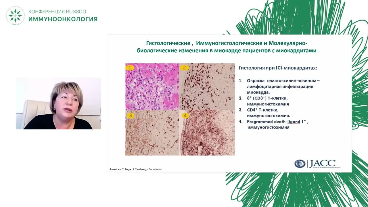Осложнения иммунотерапии: миокардиты
