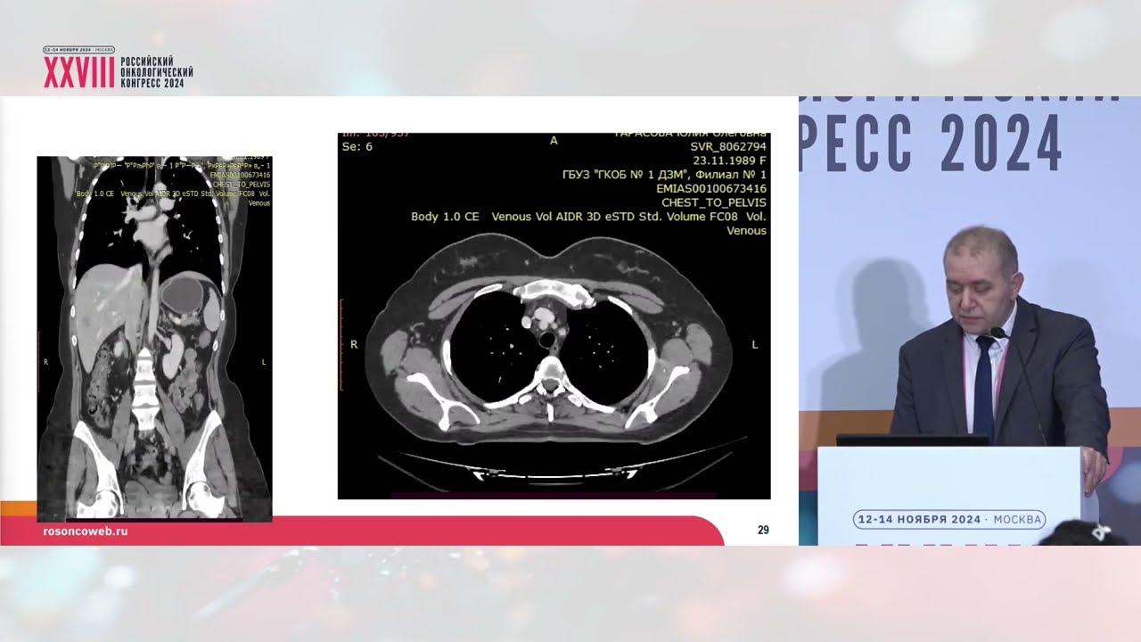 Трансплантационная онкология – миф или реальность?