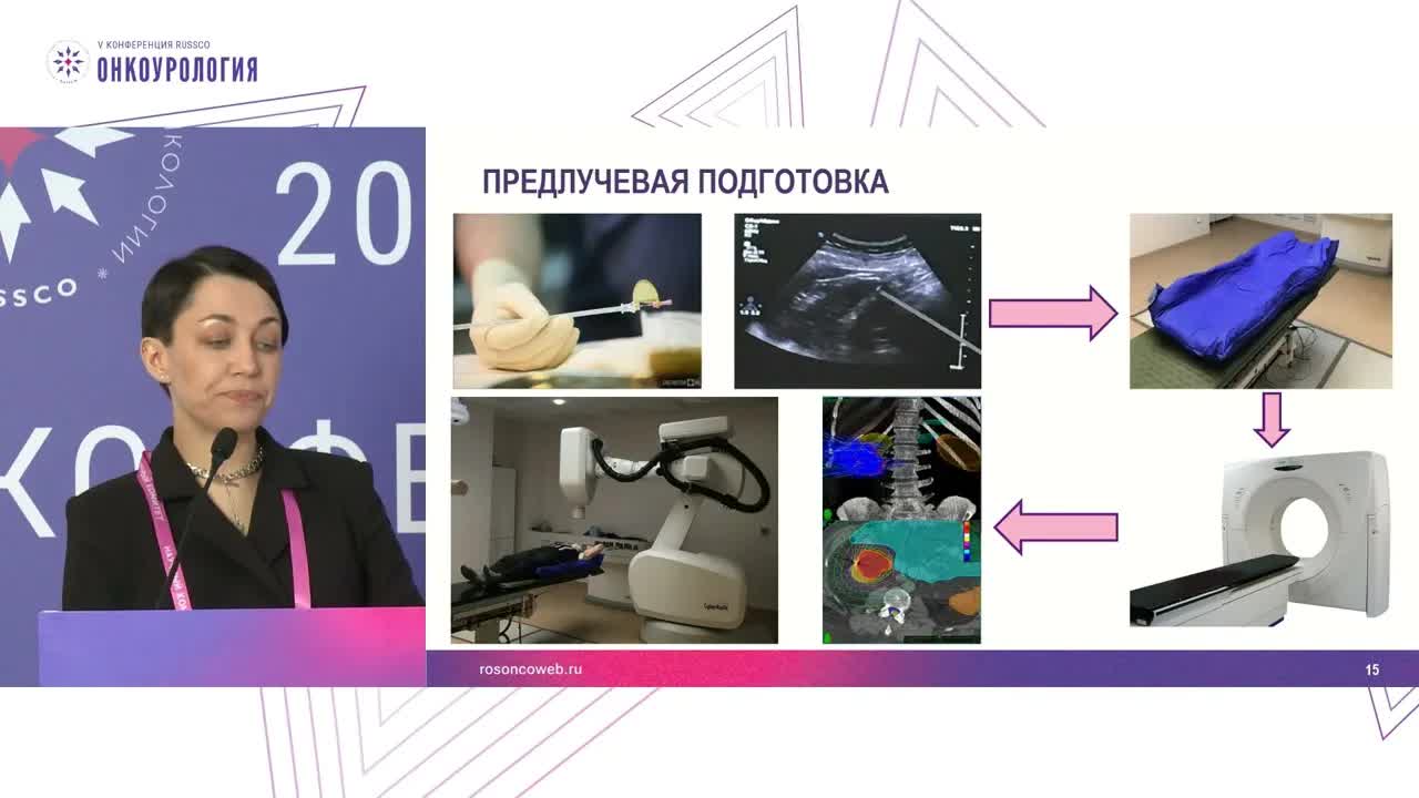 SBRT при раке почки I стадии: паллиатив или радикальность?