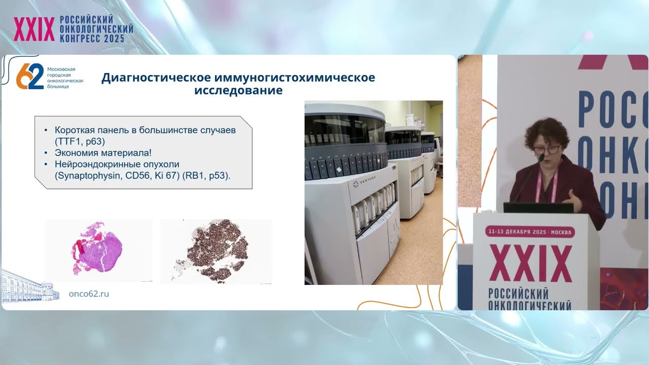 Принципы маршрутизации биоматериала пациентов в МО ДЗМ при раке легкого