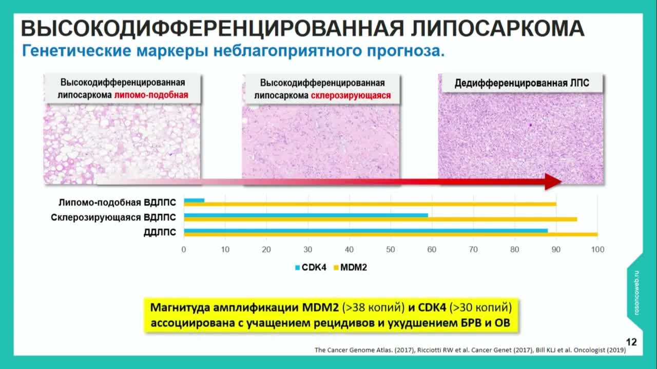 Морфологические аспекты забрюшинных липосарком: современная концепция