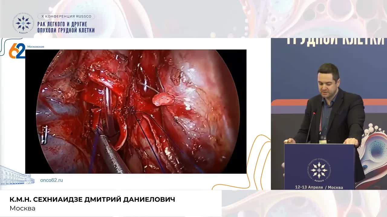 Бронхоангиопластичеcкая хирургия НМРЛ