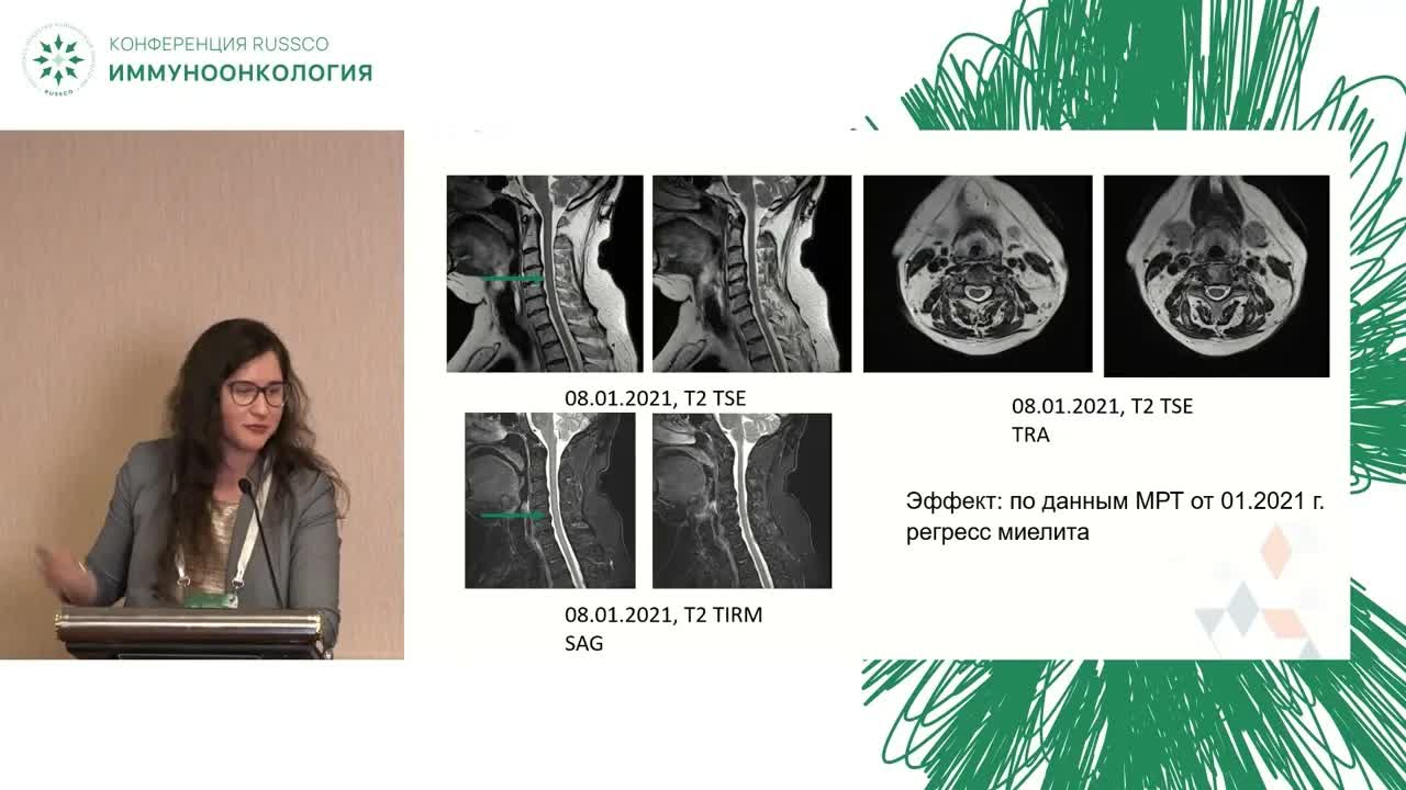 редкие побочные эффекты иммунотерапии: и колесо не всегда по одной колее катится. Клинический случай 2
