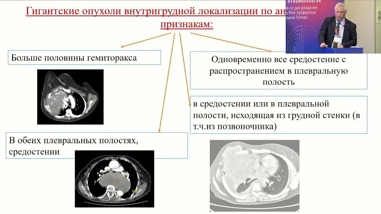 Диагностика и роль хирургического метода в лечении гигантских опухолей внутригрудной локализации