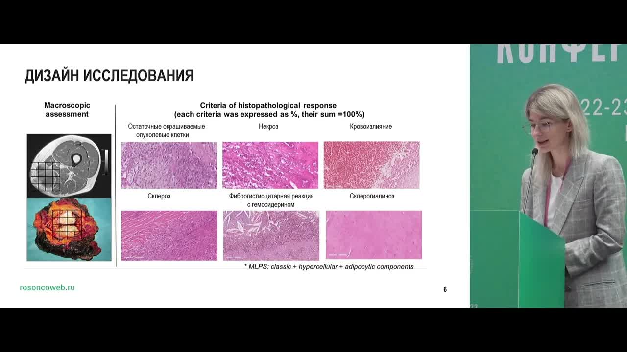 Дуэты в онкологии – саркомы. Доклад Тарарыковой А.А.