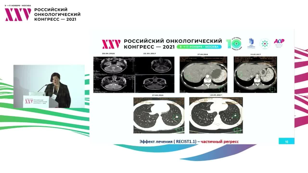 Люминальный мРМЖ у молодой женщины: что делать, когда исчерпаны стандарты? 