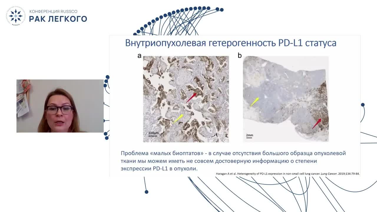 Терапия метастатического НМРЛ. Иммунотерапия для всех – польза или трата ресурса?