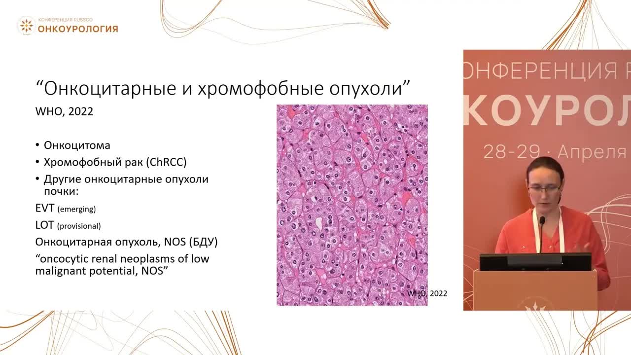 Новая патоморфологическая классификация рака почки на горизонте. Что необходимо знать клиническому онкологу?