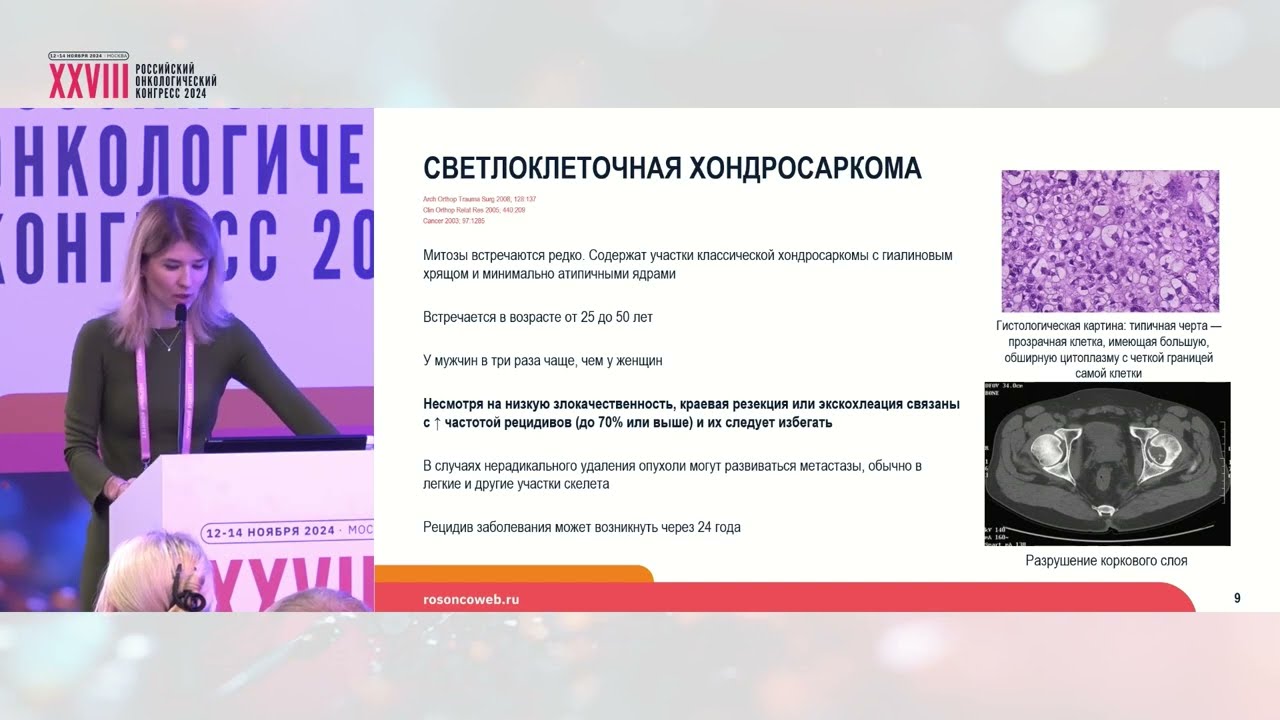 Хондросаркома: редкие подтипы