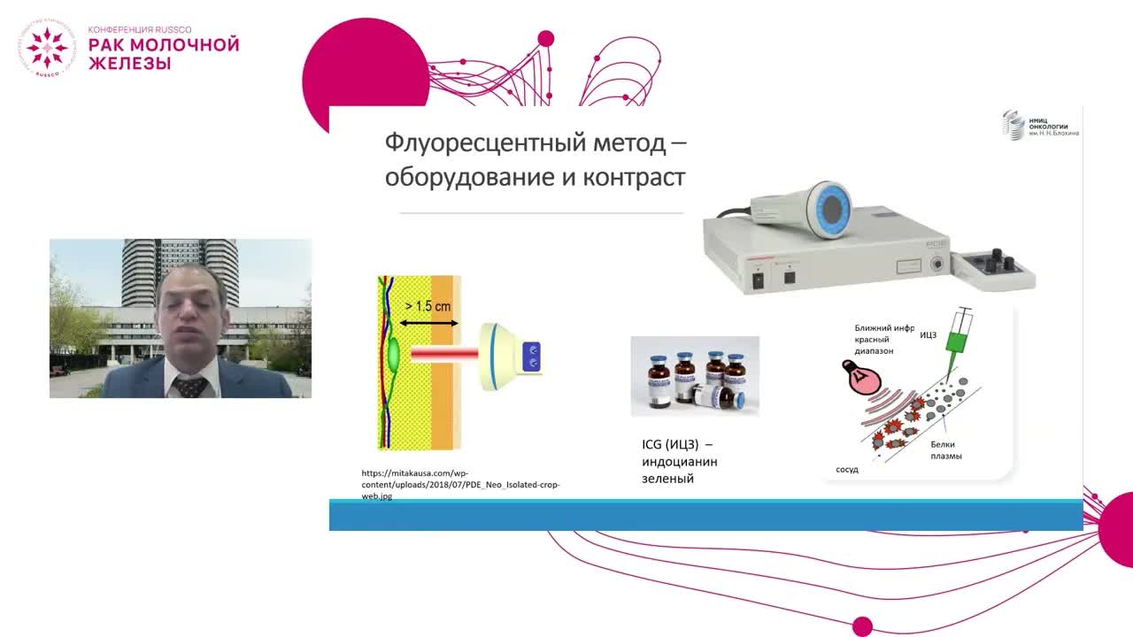 Что мешает развивать хирургию рака молочной железы в Российской Федерации?
