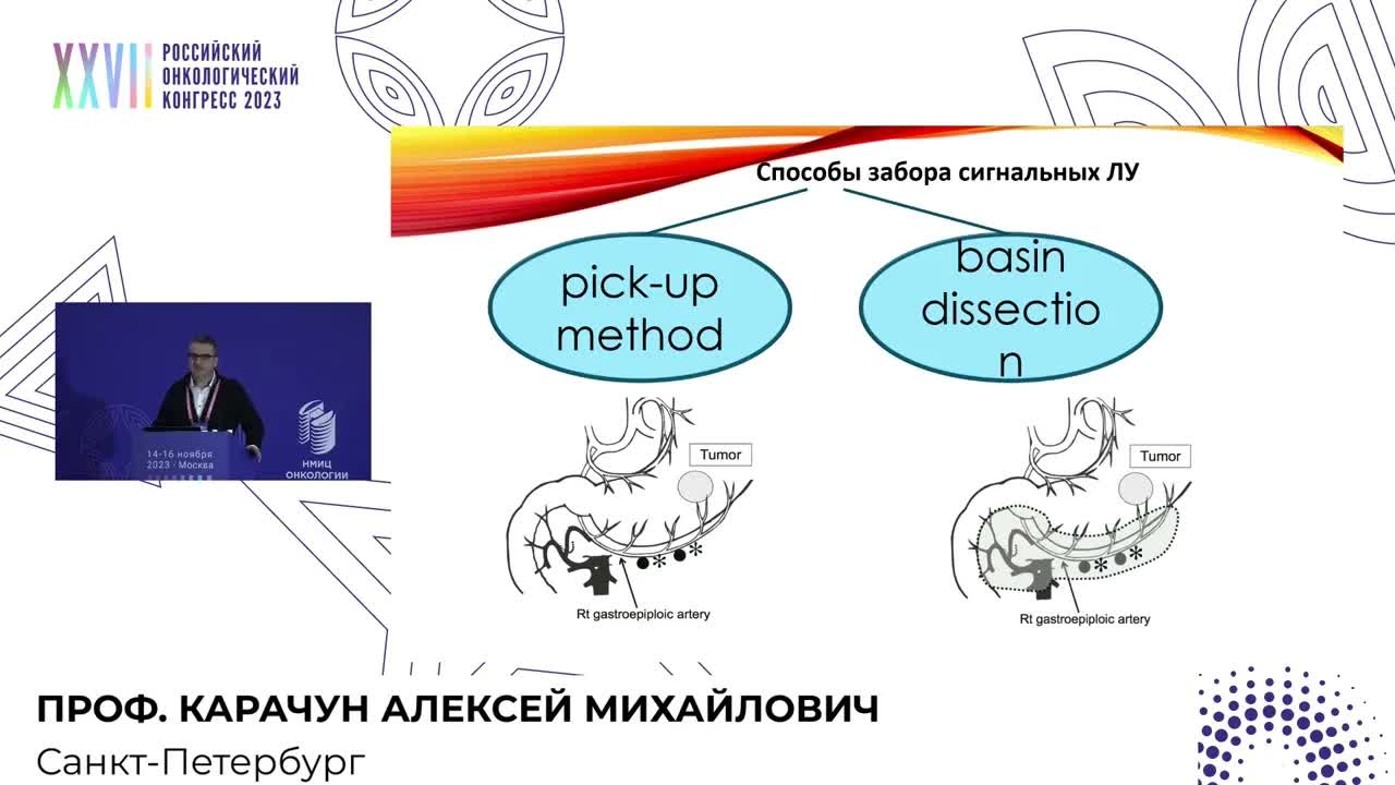 Биопсия сторожевого лимфоузла при опухолях ЖКТ