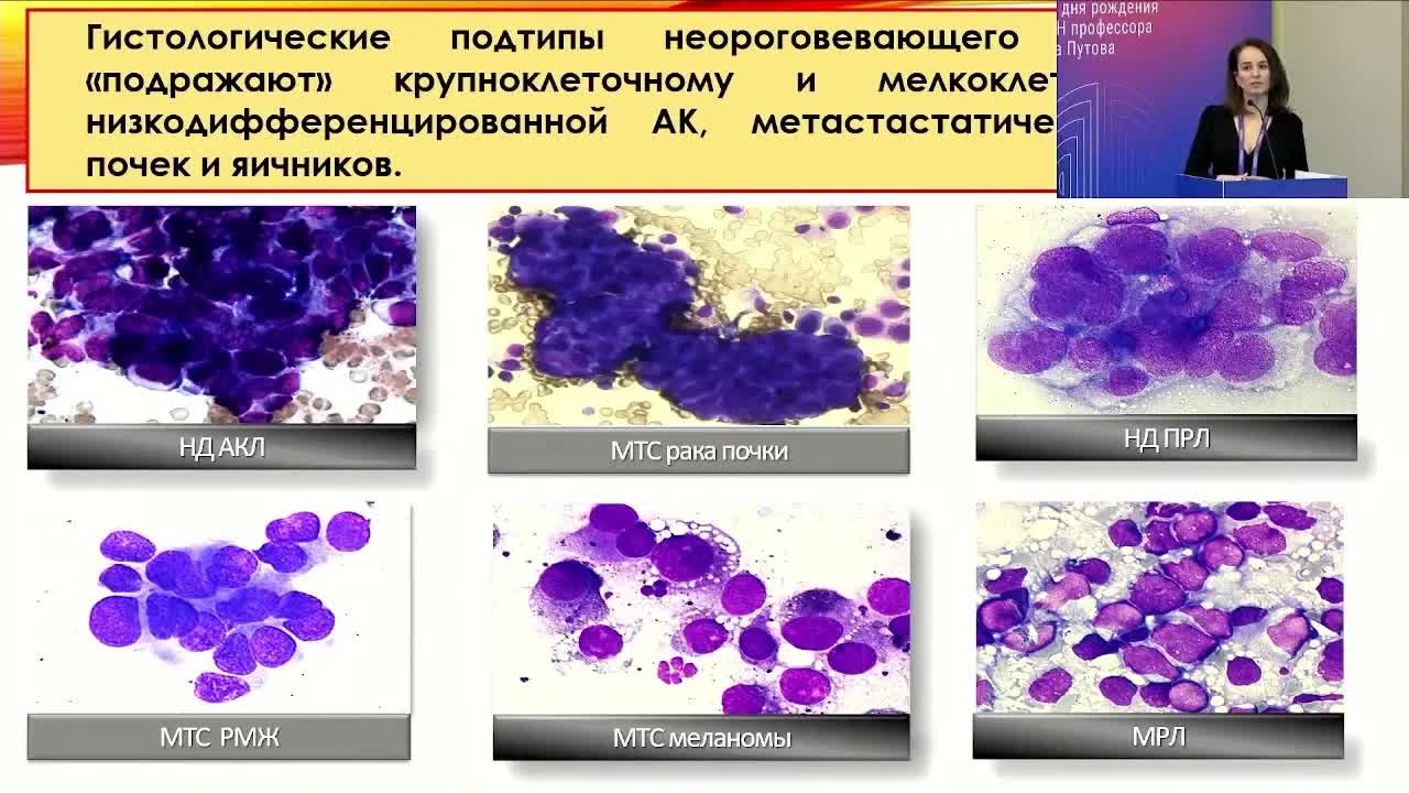 Новый взгляд на цитологическую диагностику НМРЛ