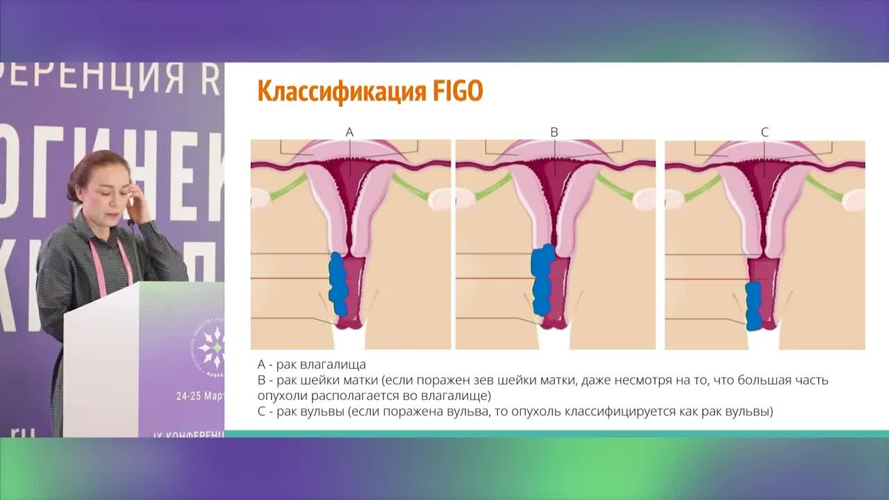 Особенности ЛТ и ХЛТ при различных редких плоскоклеточных раках (рак вульвы, влагалища)