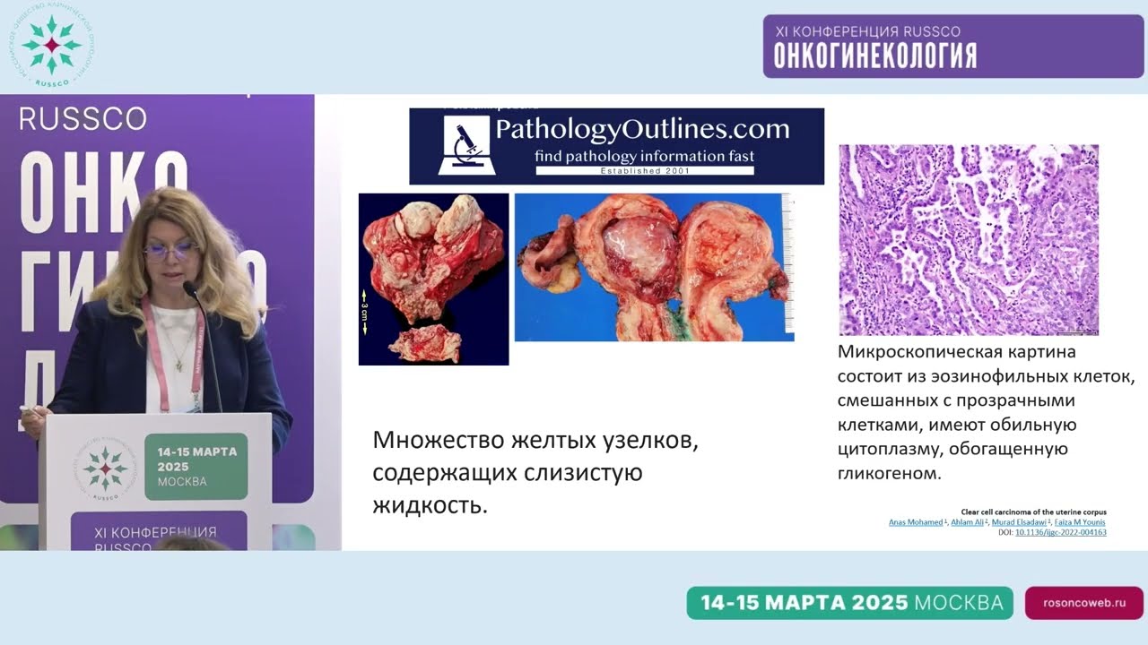 Особенности лечения светлоклеточных опухолей тела матки