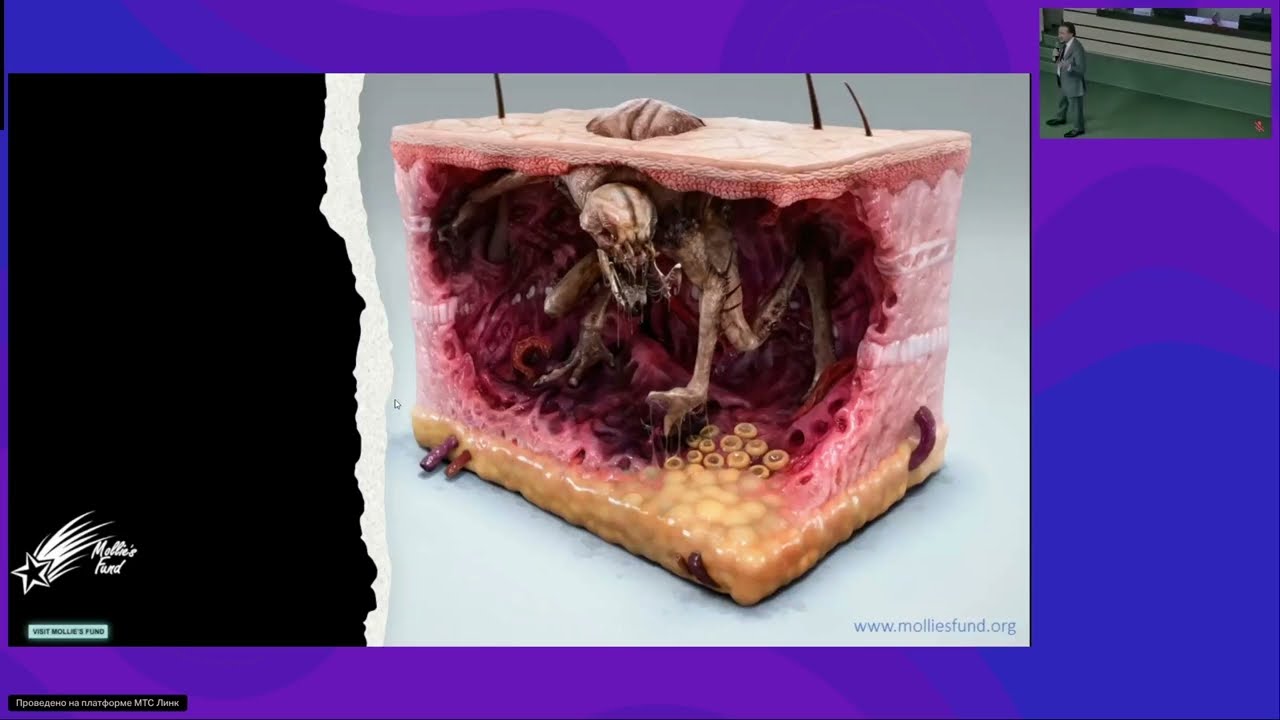 Диагностика меланоцитарных образований кожи. Мастер-класс