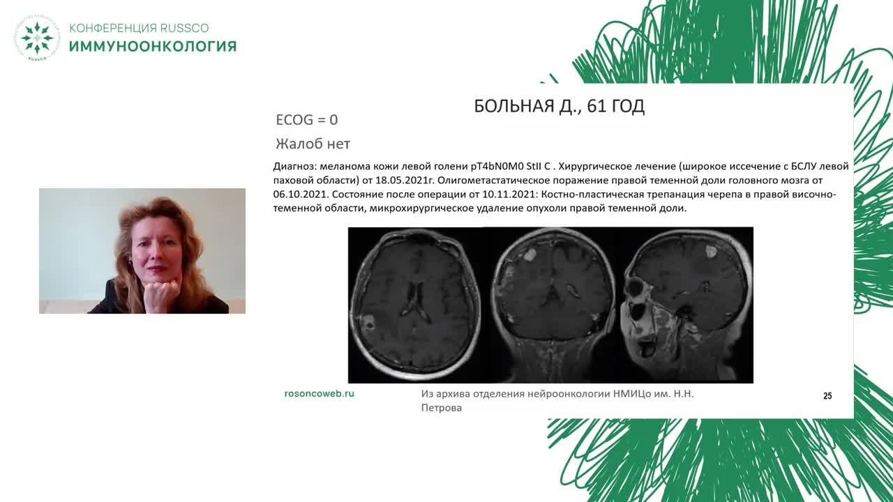 Олигометастатическое поражение ЦНС (симптомное)