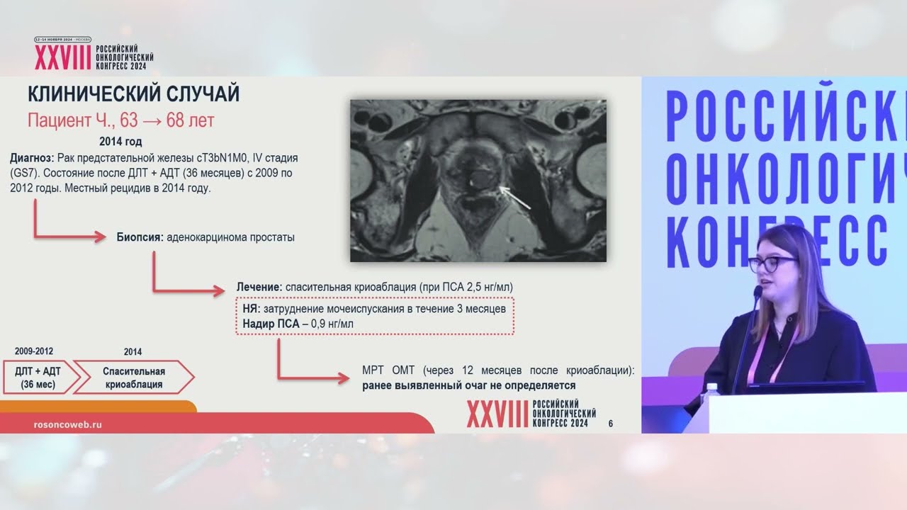 Обсуждение клинического случая: рак предстательной железы