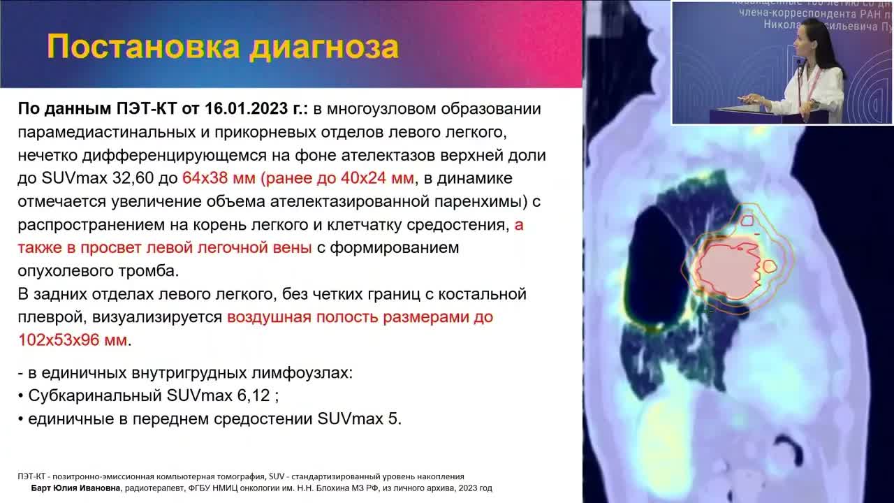 Разбор спорных клинических случаев назначения лучевой терапии