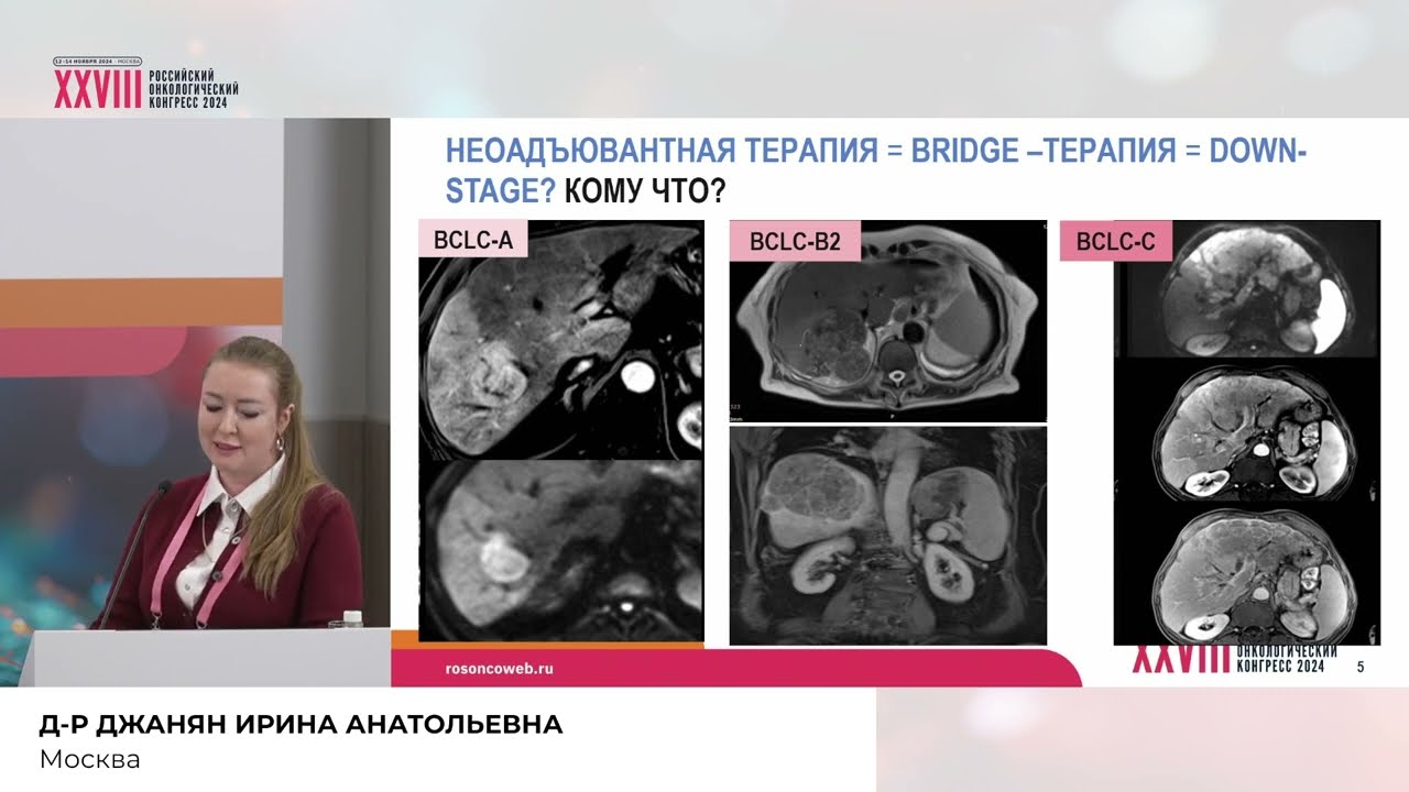 Предоперационная лекарственная терапия ГЦР: кто и когда решает?