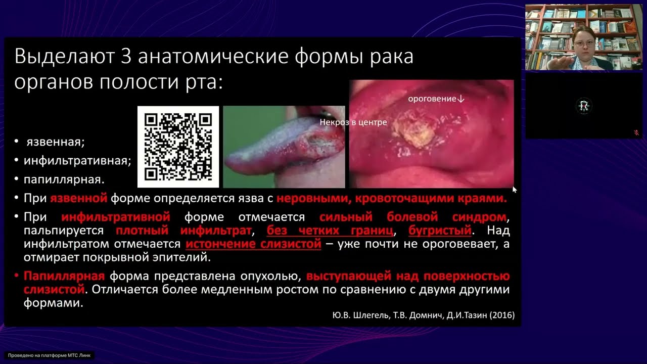 Предрак и рак слизистой полости рта – особенности стоматологической диагностики (10 ноября 2025)