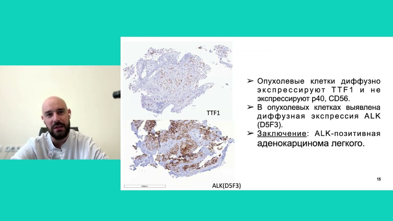 Тактика лечения по результатам тестирования. Наблюдение для морфолога