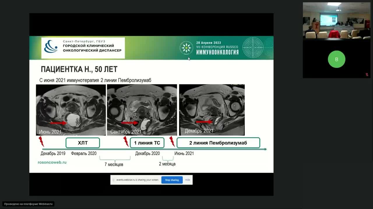 Иммуноонкология. Клинический случай пациента с метастатической меланомой