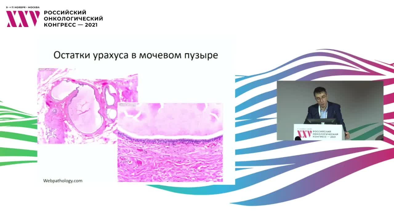 Клинические аспекты морфологической диагностики и биологического разнообразия уротелиального рака