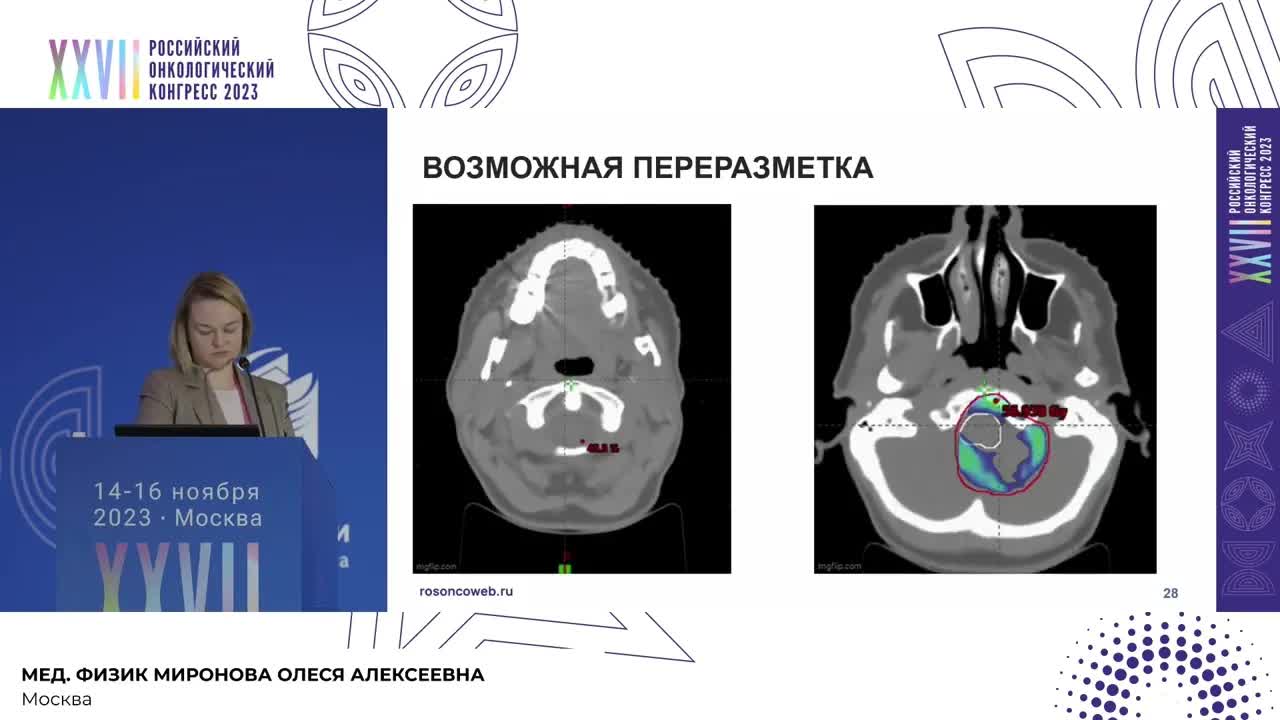 Невозможность соблюдения ограничений на органы при дозиметрическом планировании: чем жертвовать?