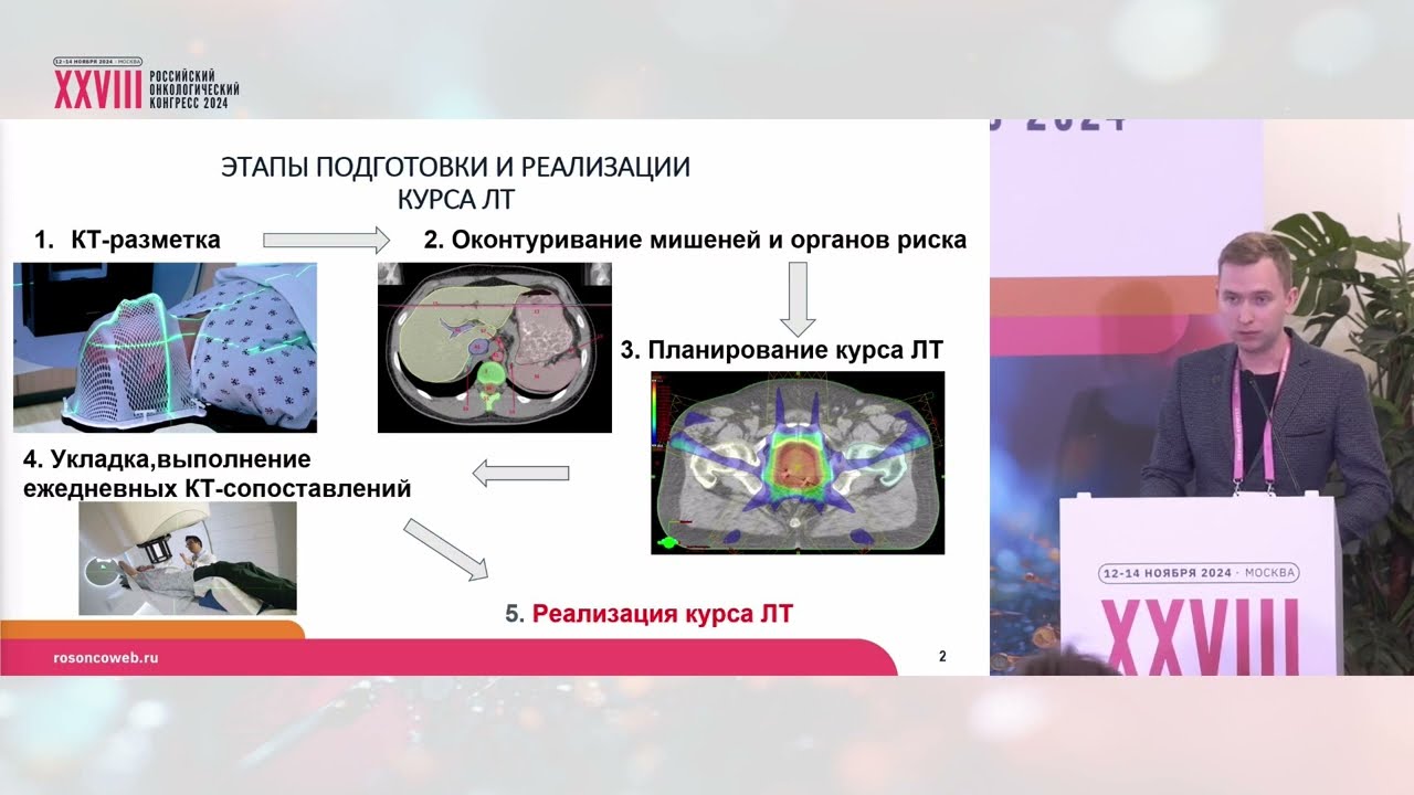 Искусственный интеллект в работе врача радиотерапевта – настоящее и будущее