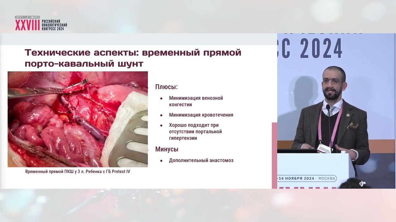 Роль пересадки печени в лечении гепатобластомы